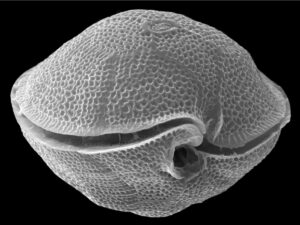 Ein Dinoflagellaten der Gattung Gambierdiscus unter dem Rasterelektronenmikroskop