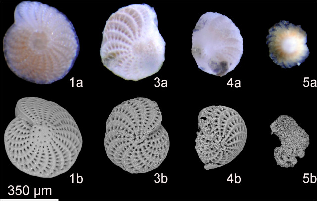 Mikroskopische Bilder von Foraminiferen
