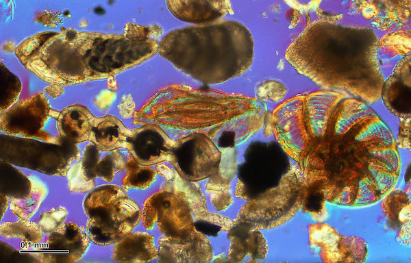 Verschiedene Foraminifera unter dem Mikroskop